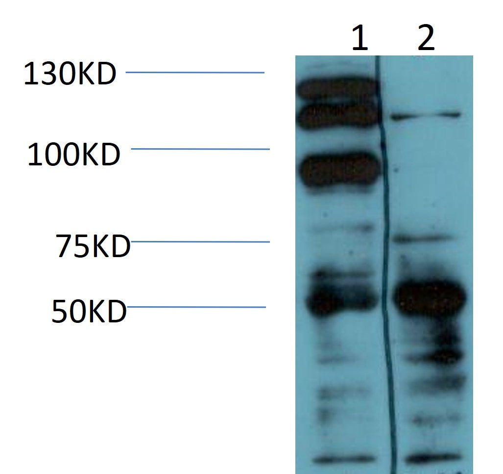 NF-kB P105 P50 Monoclonal Antibody (4D11)