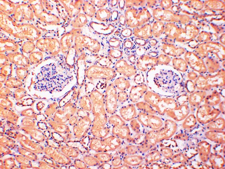 ERK5 Monoclonal Antibody (4D6)