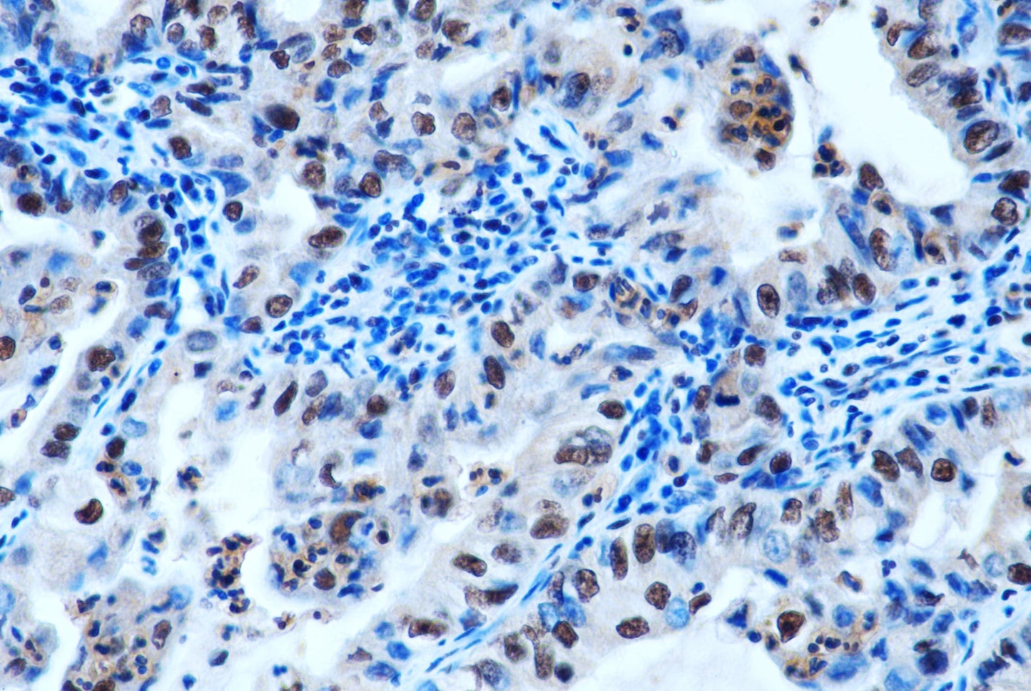 S100 A8+A9 Complex Monoclonal Antibody (11C12)