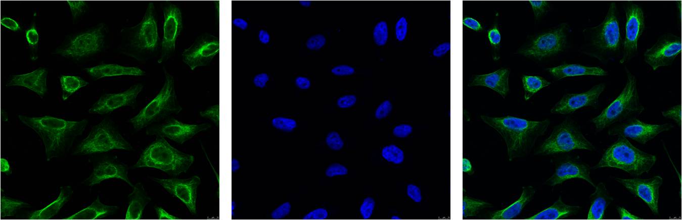 Aquaporin 4 Monoclonal Antibody (4H1)