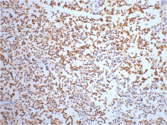 NSE Monoclonal Antibody (13E2)
