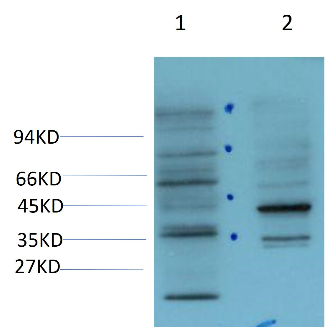 CDX-2 Monoclonal Antibody (8D9)