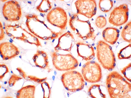 ERK5 Monoclonal Antibody (6D10)