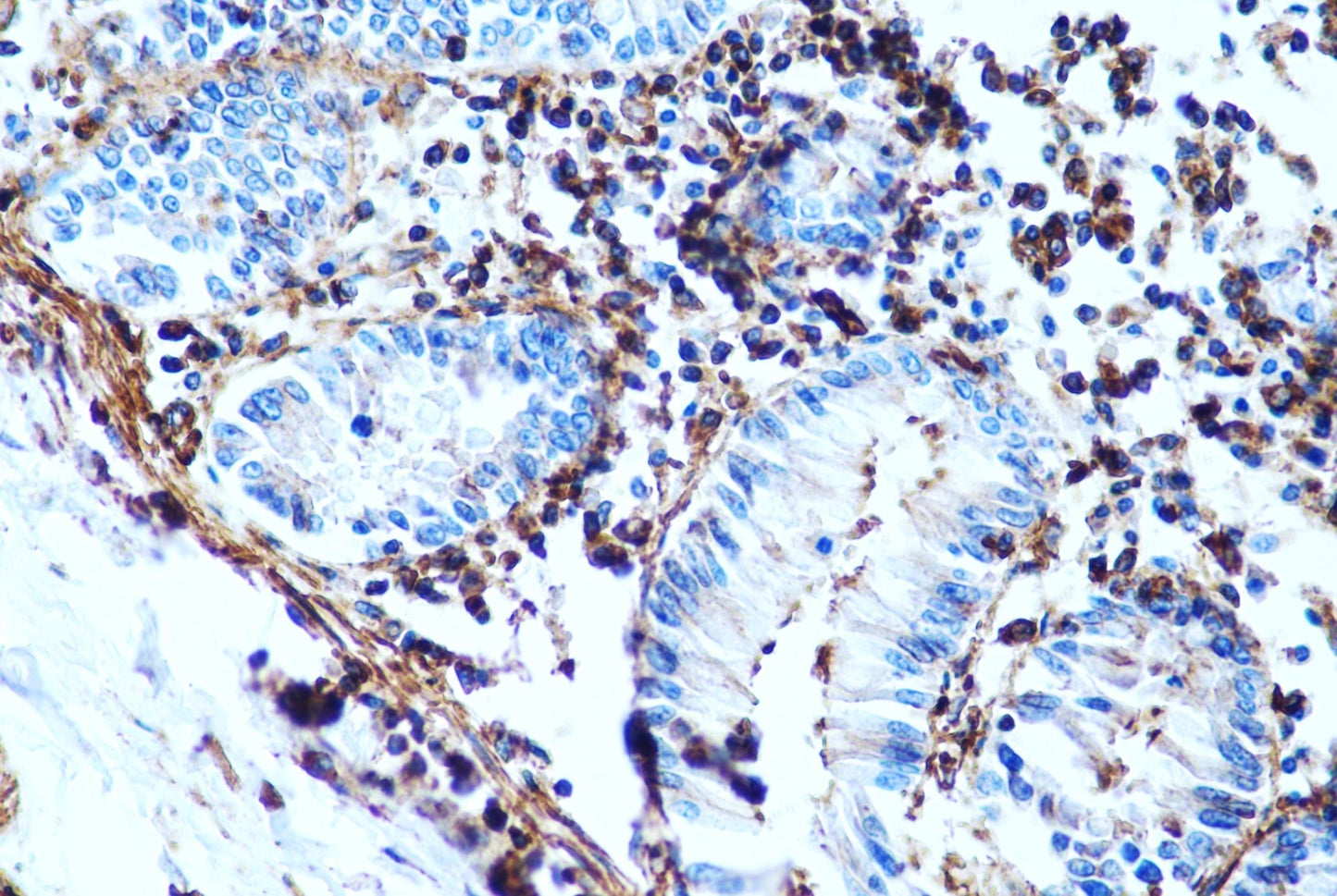 HIF-1Alpha Monoclonal Antibody (5B1)