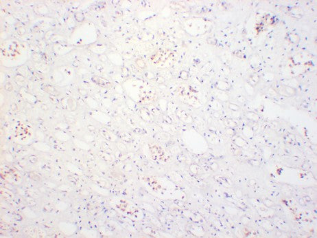 PCSK9 Monoclonal Antibody (5G4)