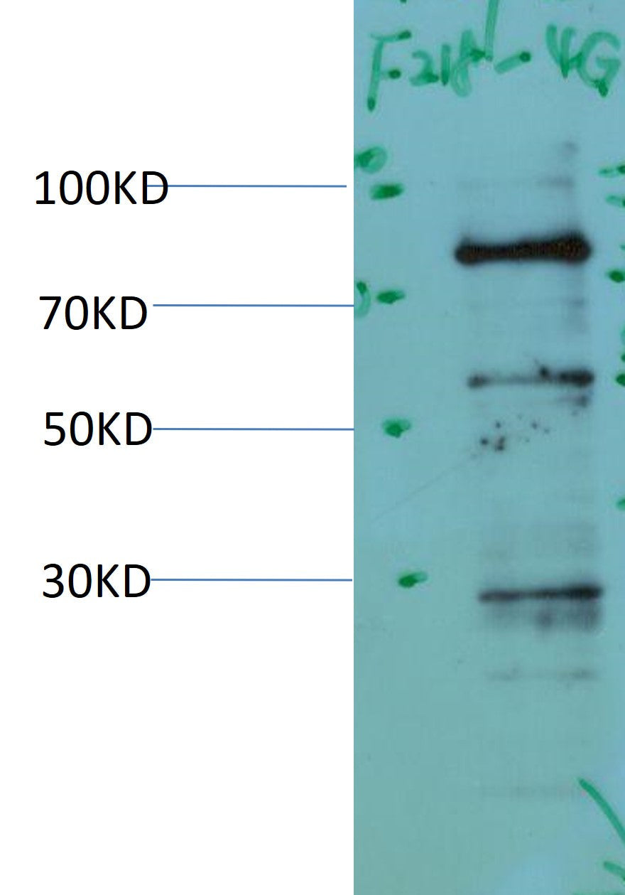 PI3K P85Alpha Monoclonal Antibody (4G2)
