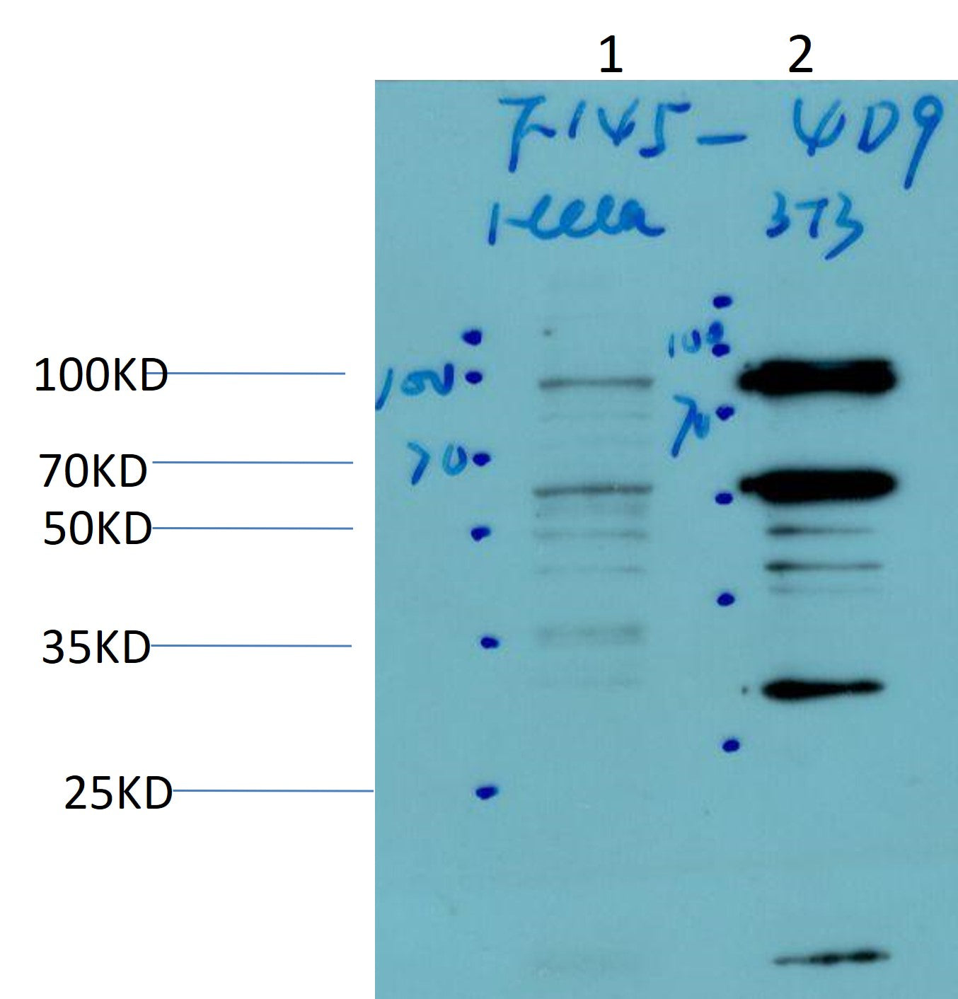 HIF-1Beta ARNT Monoclonal Antibody (4D9)