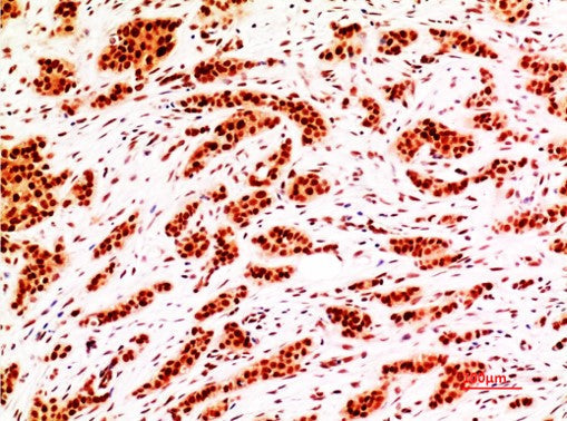 Phospho-GSK3Beta (Ser9) Monoclonal Antibody (6H9)