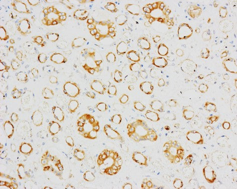 ACE2 Monoclonal Antibody (2C1)