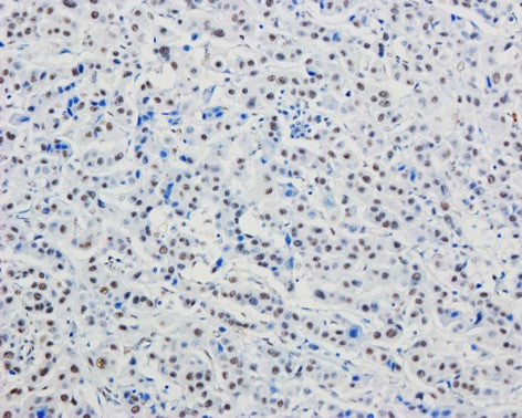 SPHK2 Monoclonal Antibody (7H5)