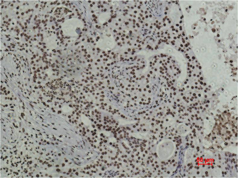 Histone H3 (tri methyl K79) Monoclonal Antibody (1B7)