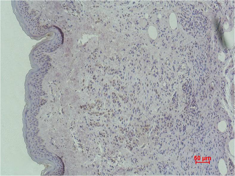 Histone H3 (mono methyl K79) Monoclonal Antibody (5G5)