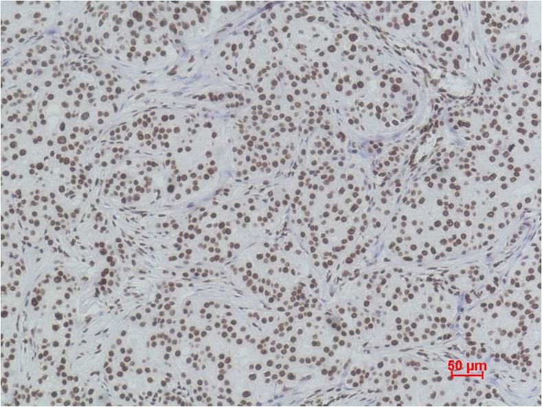 Histone H3 (tri methyl K79) Monoclonal Antibody (5D8)