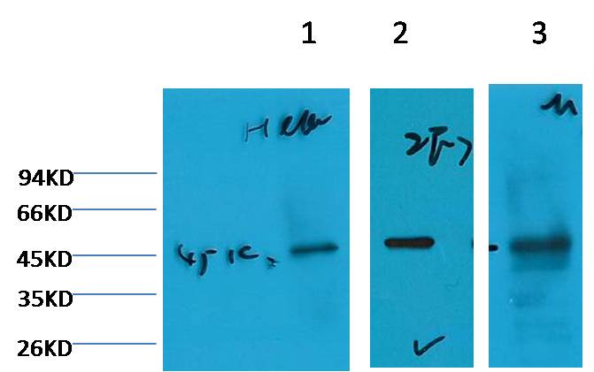 Cytokeratin 18 Monoclonal Antibody (2F7)