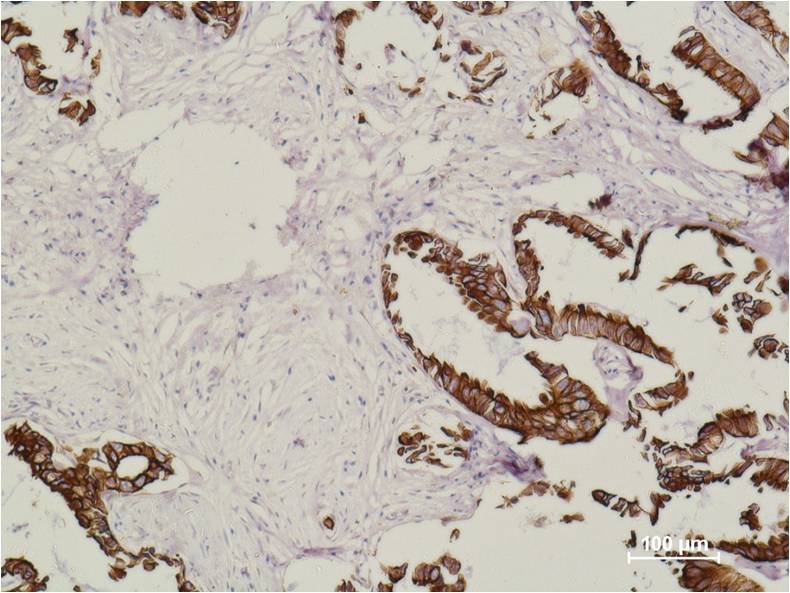 Cytokeratin 18 Monoclonal Antibody (8F2)
