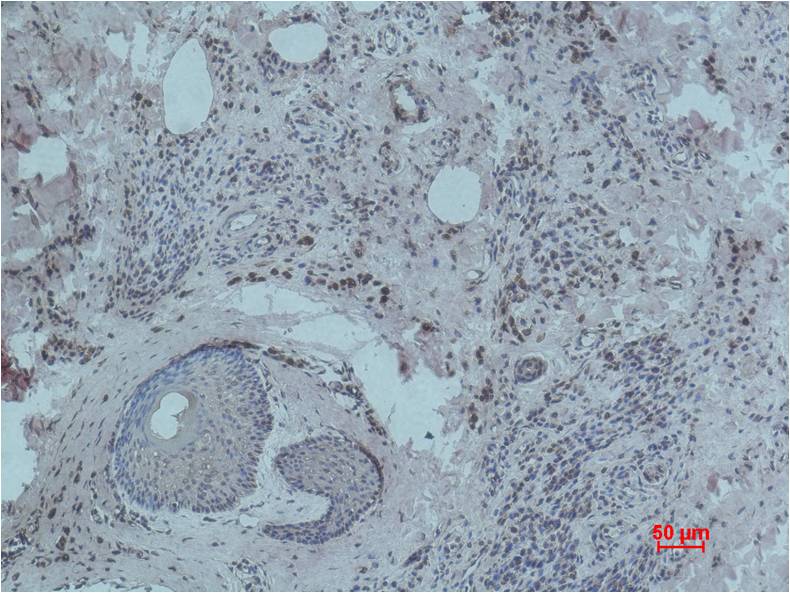 Histone H3 (mono methyl K79) Monoclonal Antibody (1C2)