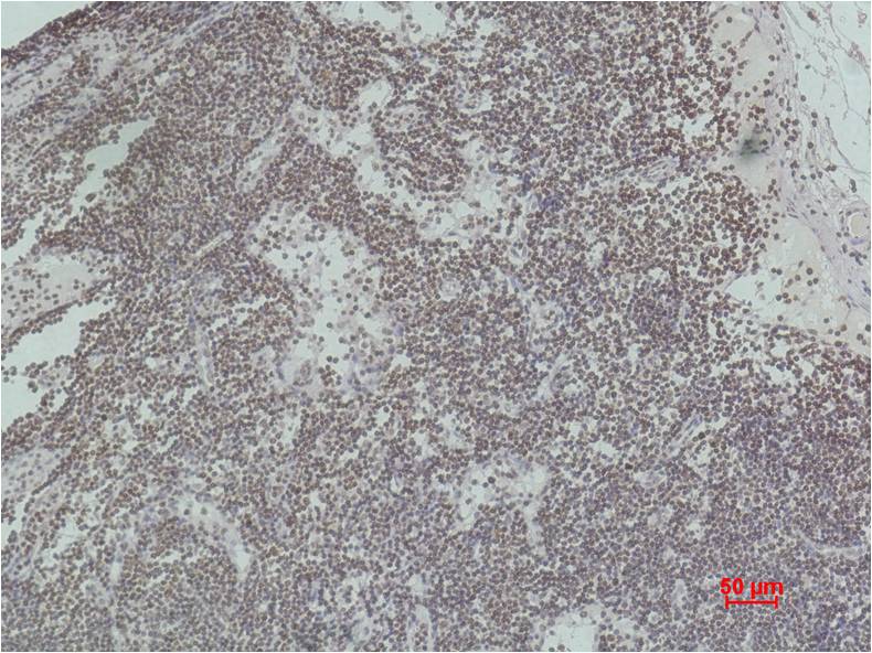 Histone H3 (tri methyl K4) Monoclonal Antibody (2E11)