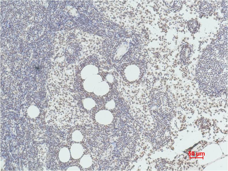 Histone H3 (di methyl K36) Monoclonal Antibody (1E6)