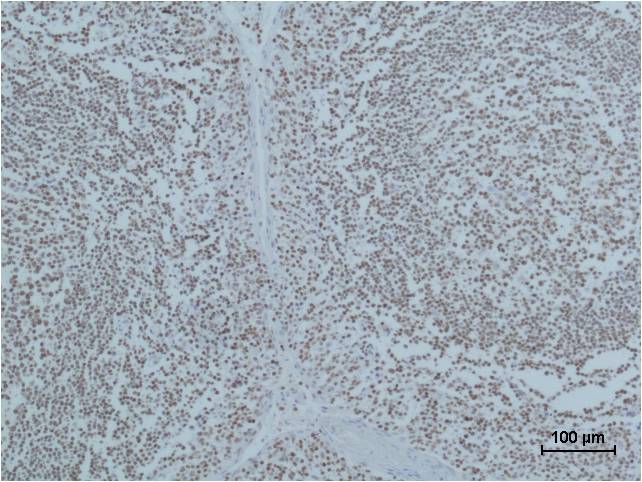 PARP Monoclonal Antibody (M3)