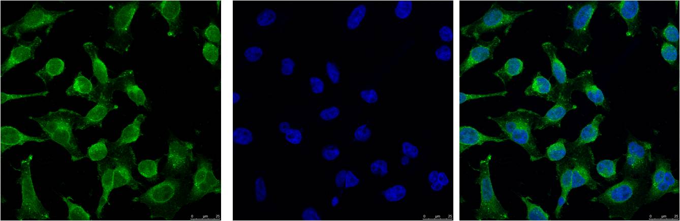 EGFR Monoclonal Antibody (M6)