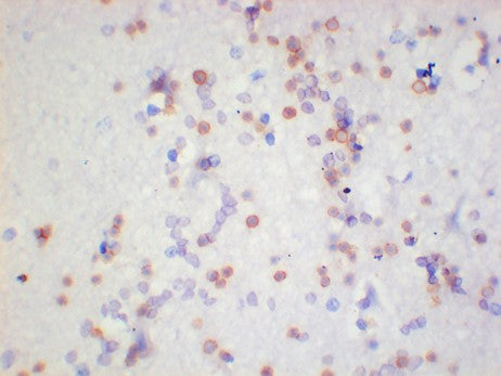 alpha-Syneuclein Monoclonal Antibody (2E2)