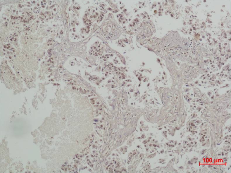 CREB Polyclonal Antibody