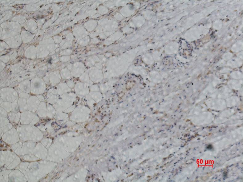PRDX1 Polyclonal Antibody