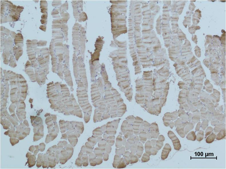 Alpha-Skeletal Muscle Actin Polyclonal Antibody