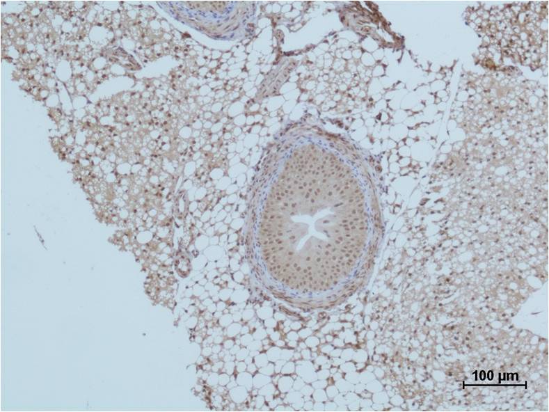 Histone H2A.Z Polyclonal Antibody