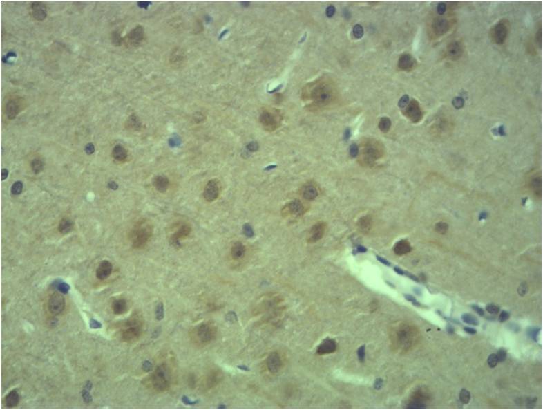 GAP43 Polyclonal Antibody