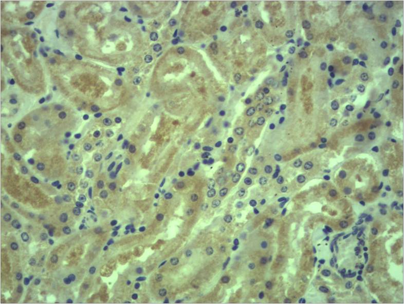 Akt3 Polyclonal Antibody
