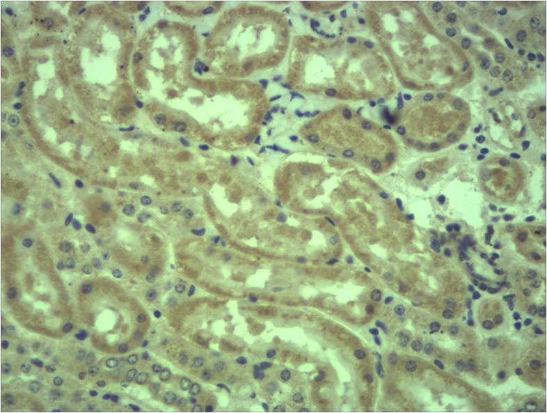 c-Myc Polyclonal Antibody