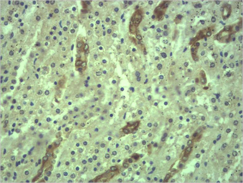Cytokeratin18 Polyclonal Antibody