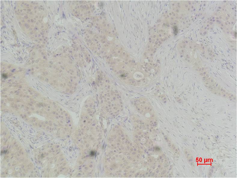 Histone H3 (Phospho Thr118) Polyclonal Antibody