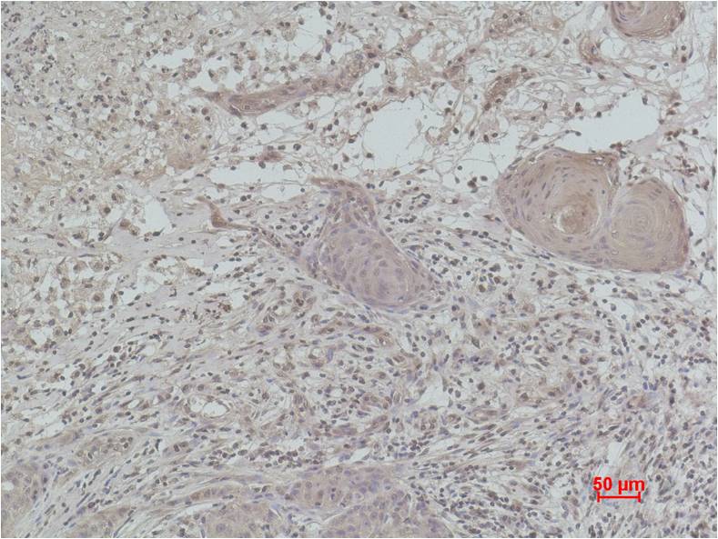 Histone H1 (Mono Methyl Lys25) Polyclonal Antibody