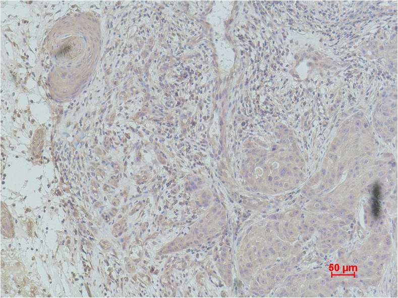 Histone H2B (Mono Methyl Lys5) Polyclonal Antibody