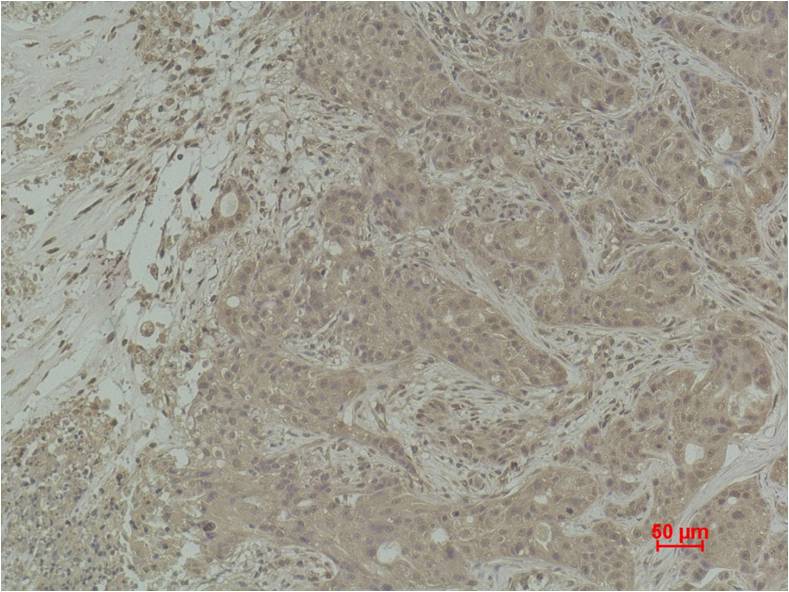 Histone H2B (Di Methyl Lys5) Polyclonal Antibody