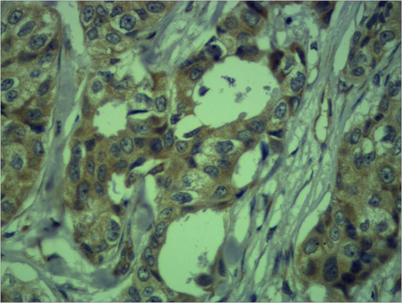 Vimentin Polyclonal Antibody