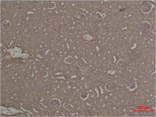 HIF-1Alpha Polyclonal Antibody