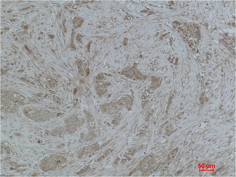 Histone H3 (Acetyl Lys79) Polyclonal Antibody