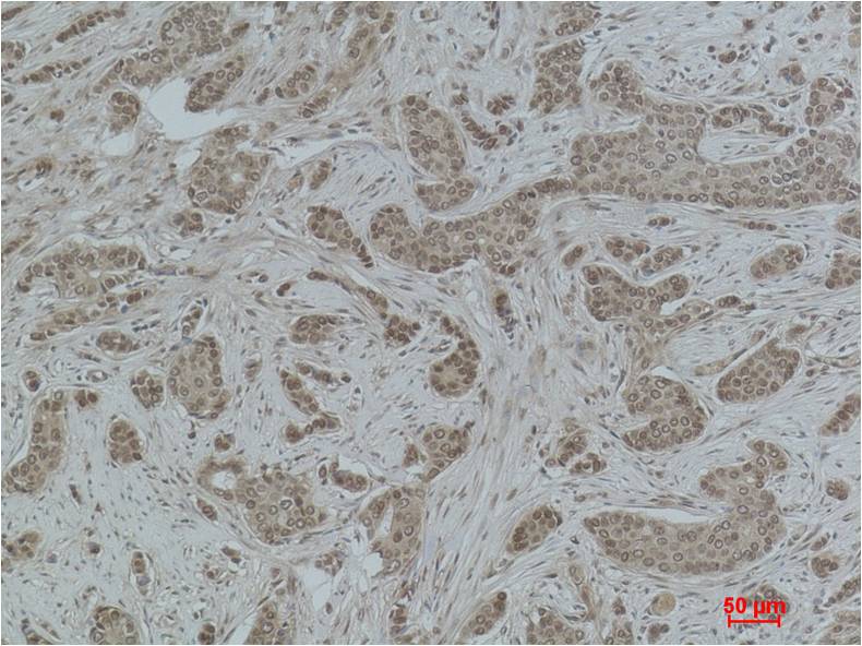 Histone H2B (Acetyl Lys15) Polyclonal Antibody