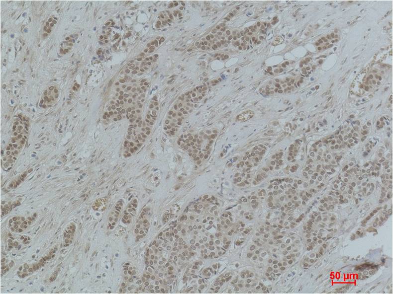 Histone H2B (Acetyl Lys20) Polyclonal Antibody