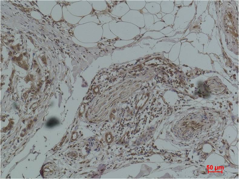 Histone H1 (Phospho Ser1) Polyclonal Antibody