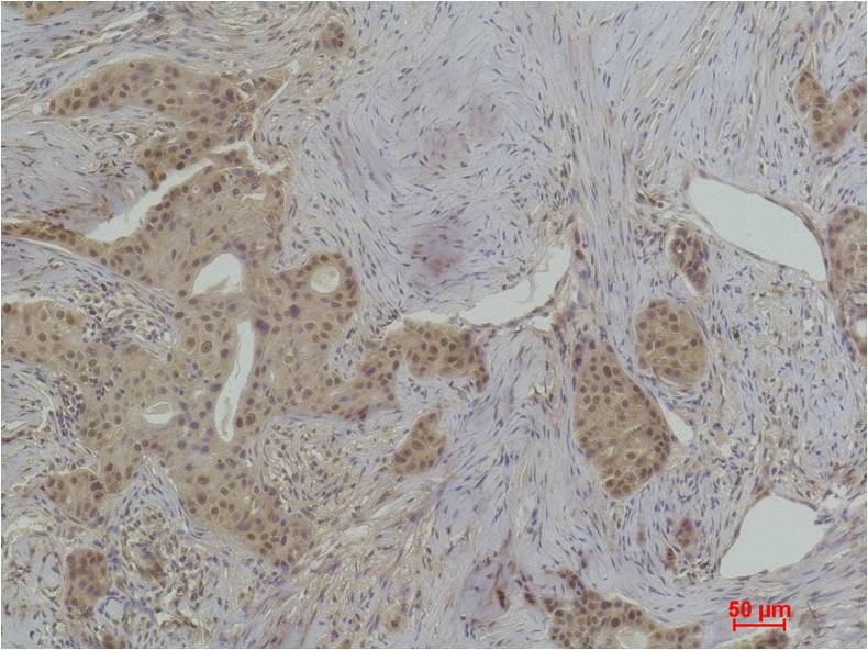 Histone H1 (Phospho Thr17) Polyclonal Antibody