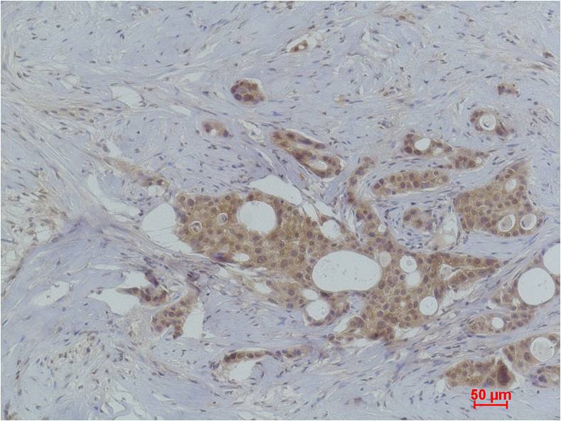 Histone H2A.X (Phospho Tyr142) Polyclonal Antibody