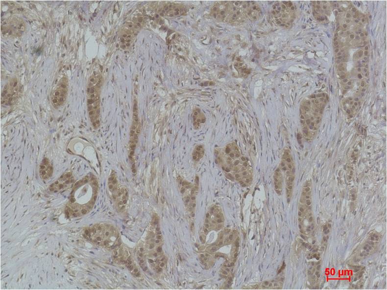 Histone H2B (Phospho Ser14) Polyclonal Antibody
