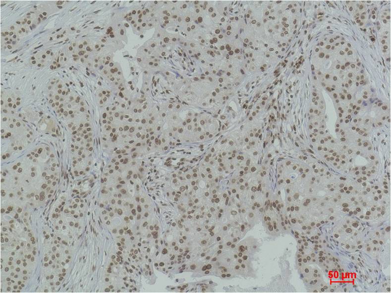 Histone H3 (Di Methyl Lys4) Polyclonal Antibody