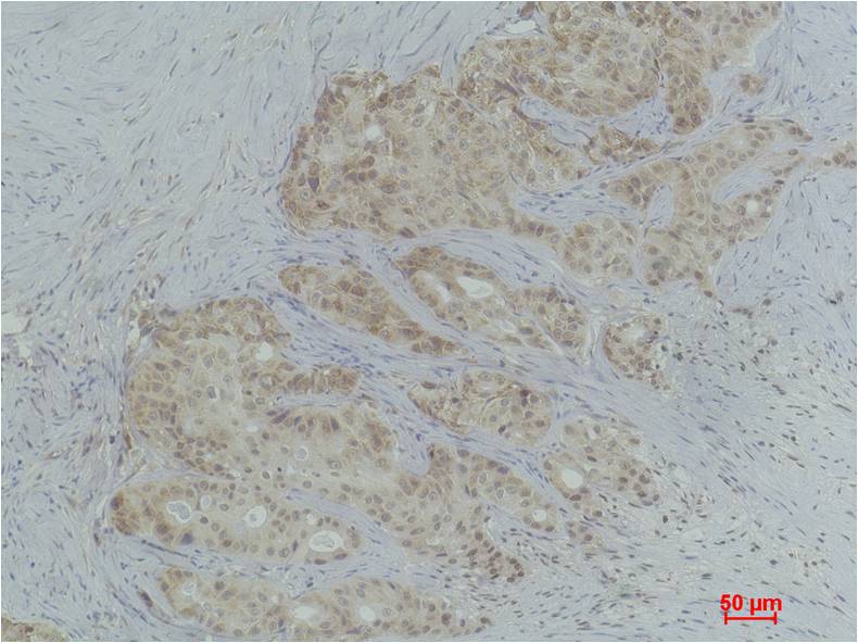 Histone H3 (Tri Methyl Lys4) Polyclonal Antibody