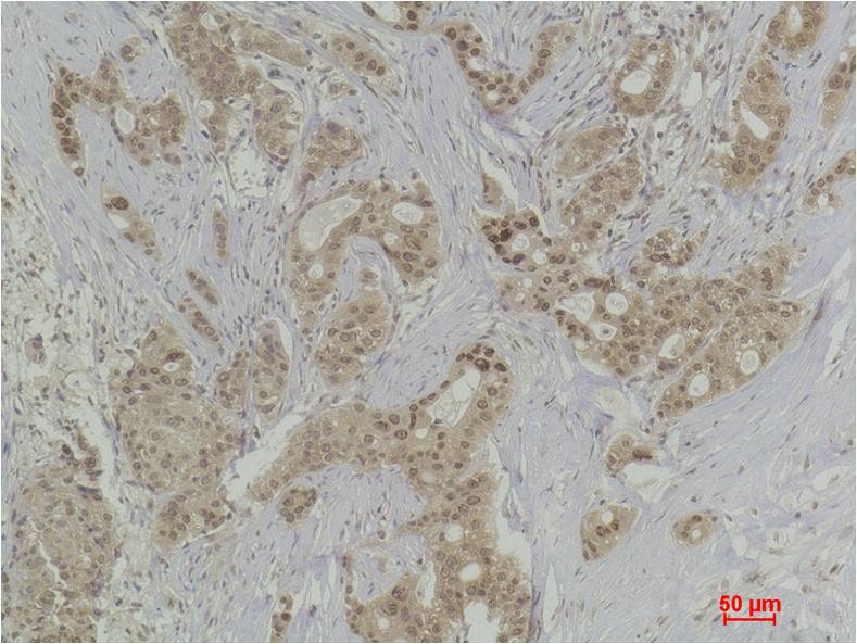 Histone H2B (Tri Methyl Lys5) Polyclonal Antibody