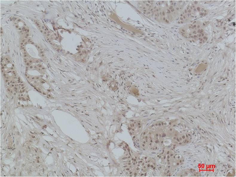 Histone H3 (Mono Methyl Lys4) Polyclonal Antibody